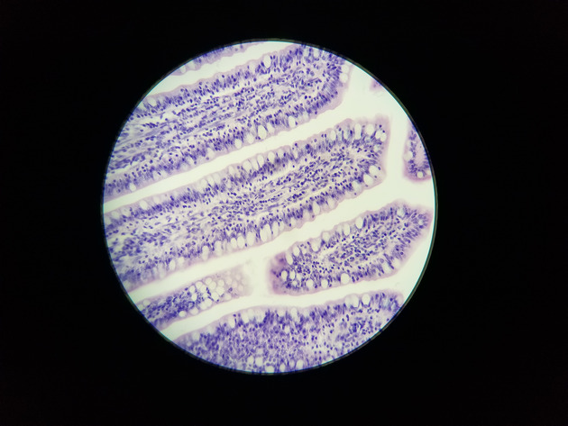 Simple Columnar Epithelium Slides - Simple Columnar Epithelium 06 100X